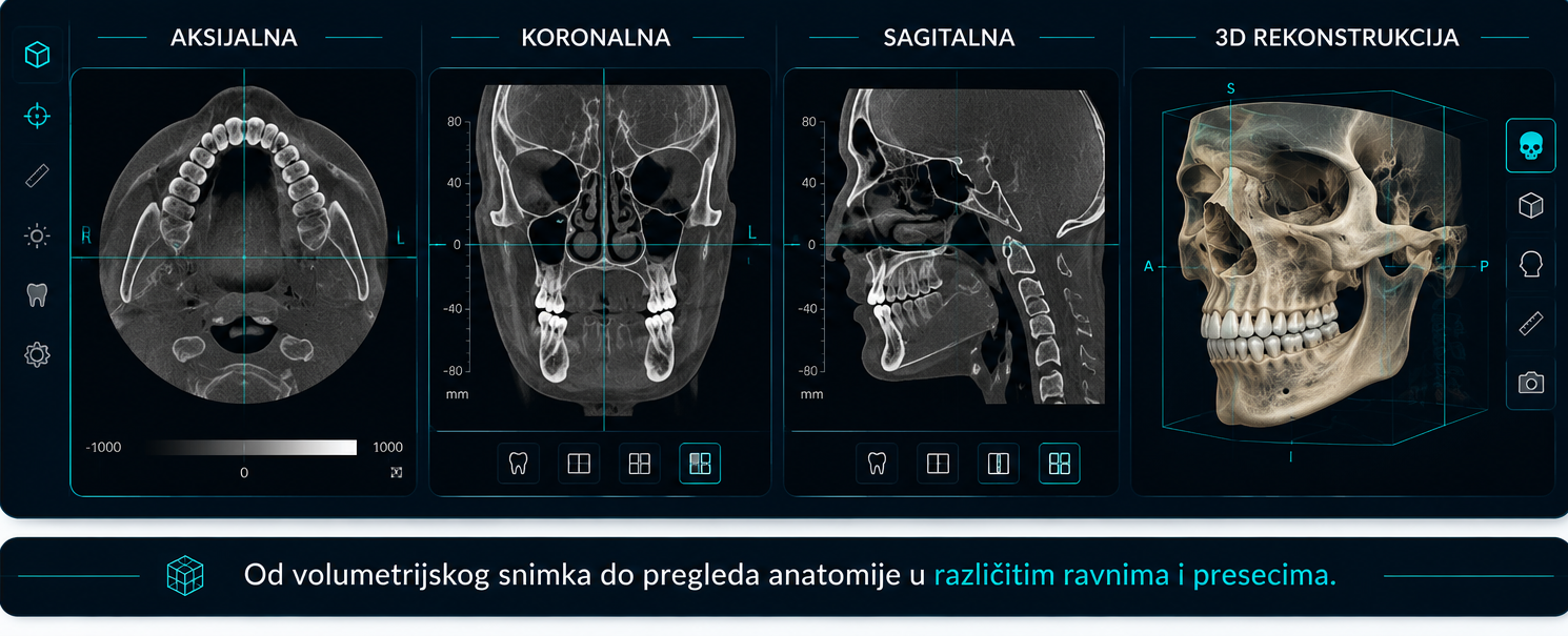 3d snimanje zuba cbct