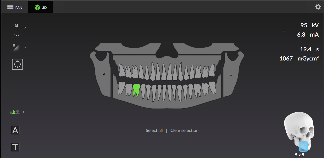 3D snimanje za endodonciju 3D-snimanje-za-endodonciju