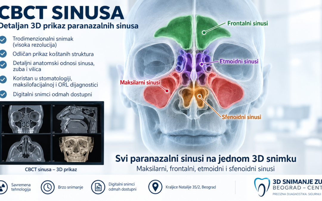 CBCT-sinusa