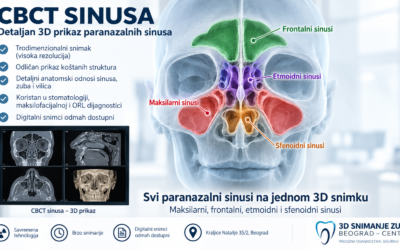Snimanje sinusa – CBCT ili CT? Koja je razlika i kada se radi 3D snimak sinusa