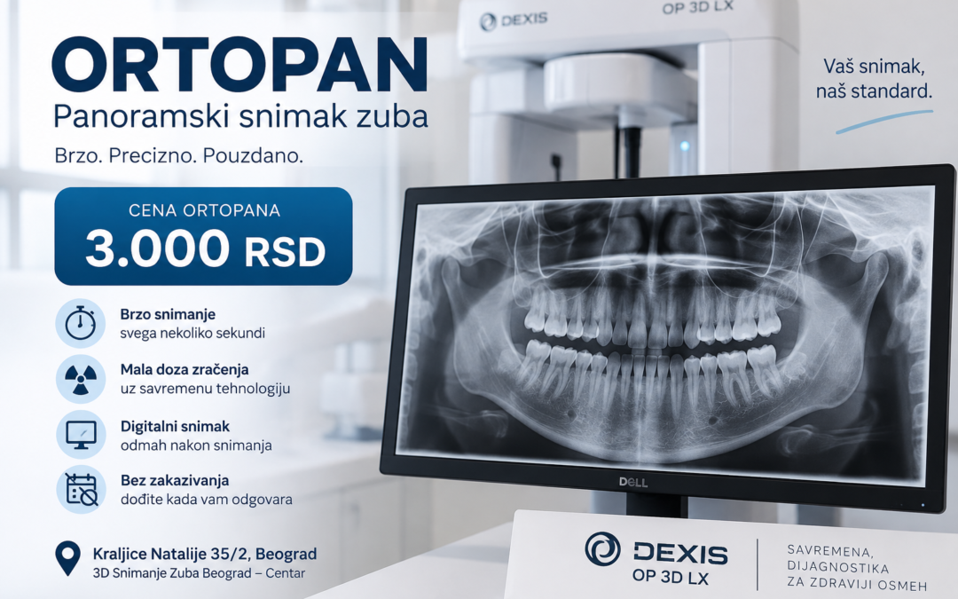 Ortopan cena – koliko košta panoramski snimak zuba u Beogradu?