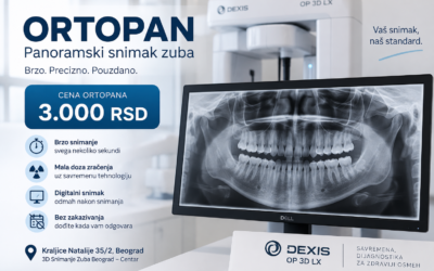 Ortopan cena – koliko košta panoramski snimak zuba u Beogradu?